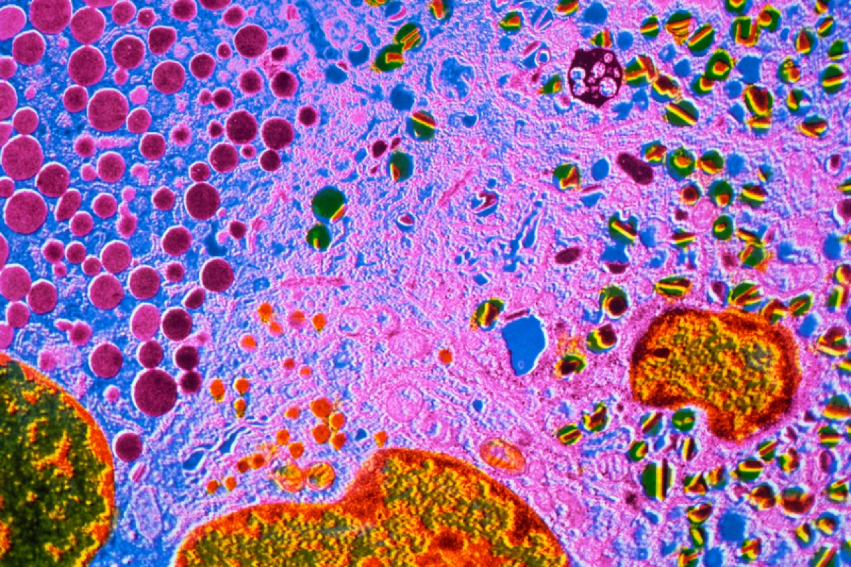 Клетки поджелудочной. Langerhans Cells. Бета клетки поджелудочной железы. Клетка поджелудочной железы под микроскопом. Поджелудочная железа под микроскопом.